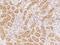 Homeobox B9 antibody, 206673-T08, Sino Biological, Immunohistochemistry paraffin image 