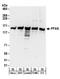 FGAM synthase antibody, A304-219A, Bethyl Labs, Western Blot image 