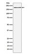 LDL Receptor Related Protein 6 antibody, M00970, Boster Biological Technology, Western Blot image 
