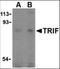 Toll Like Receptor Adaptor Molecule 1 antibody, orb86882, Biorbyt, Western Blot image 