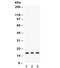 Microsomal Glutathione S-Transferase 1 antibody, R31937, NSJ Bioreagents, Western Blot image 