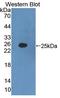 Interferon Alpha 2 antibody, LS-C697758, Lifespan Biosciences, Western Blot image 