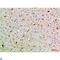 Semaphorin 7A (John Milton Hagen Blood Group) antibody, LS-C814231, Lifespan Biosciences, Immunohistochemistry paraffin image 