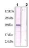 Phosphatase And Tensin Homolog antibody, TA354666, Origene, Western Blot image 