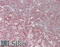 CRK Like Proto-Oncogene, Adaptor Protein antibody, 45-041, ProSci, Immunohistochemistry paraffin image 