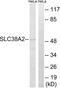 Solute Carrier Family 38 Member 2 antibody, LS-C120499, Lifespan Biosciences, Western Blot image 