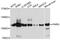 Poly(ADP-Ribose) Glycohydrolase antibody, A04301, Boster Biological Technology, Western Blot image 