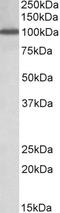 Electron transfer flavoprotein subunit beta antibody, 42-808, ProSci, Enzyme Linked Immunosorbent Assay image 