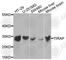 TIR Domain Containing Adaptor Protein antibody, A1943, ABclonal Technology, Western Blot image 