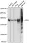 Carbamoyl-Phosphate Synthase 1 antibody, 23-386, ProSci, Western Blot image 