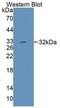 Dyskerin Pseudouridine Synthase 1 antibody, LS-C725556, Lifespan Biosciences, Western Blot image 