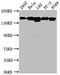 c-met antibody, CSB-RA983271A0HU, Cusabio, Western Blot image 