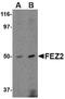 Fasciculation And Elongation Protein Zeta 2 antibody, orb88386, Biorbyt, Western Blot image 