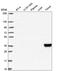 Interferon Gamma Receptor 1 antibody, HPA063871, Atlas Antibodies, Western Blot image 