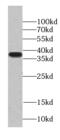 Transcriptional Adaptor 1 antibody, FNab08473, FineTest, Western Blot image 