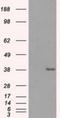 Sorbitol Dehydrogenase antibody, NBP2-02126, Novus Biologicals, Western Blot image 