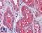 Raf-1 Proto-Oncogene, Serine/Threonine Kinase antibody, LS-B6239, Lifespan Biosciences, Immunohistochemistry frozen image 