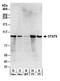 Signal Transducer And Activator Of Transcription 6 antibody, A300-415A, Bethyl Labs, Western Blot image 