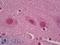 RAR Related Orphan Receptor A antibody, LS-B7055, Lifespan Biosciences, Immunohistochemistry paraffin image 