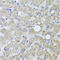 Alanyl-TRNA Synthetase 2, Mitochondrial antibody, LS-C409375, Lifespan Biosciences, Immunohistochemistry paraffin image 