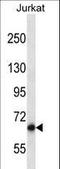 Poly(A) Specific Ribonuclease Subunit PAN3 antibody, LS-C164519, Lifespan Biosciences, Western Blot image 