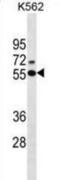 Estrogen Receptor 2 antibody, abx025483, Abbexa, Western Blot image 