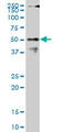 Cleavage And Polyadenylation Specific Factor 6 antibody, LS-C139441, Lifespan Biosciences, Western Blot image 