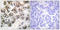 H3 Histone Family Member 3B antibody, LS-C117808, Lifespan Biosciences, Immunohistochemistry paraffin image 