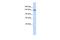 TBC1 Domain Family Member 1 antibody, PA5-44288, Invitrogen Antibodies, Western Blot image 