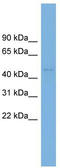 BEN Domain Containing 7 antibody, TA329784, Origene, Western Blot image 