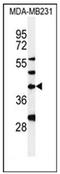 Dolichyl-Phosphate N-Acetylglucosaminephosphotransferase 1 antibody, AP51309PU-N, Origene, Western Blot image 