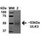 Unc-51 Like Kinase 3 antibody, SPC-642D-P594, StressMarq, Western Blot image 