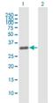 Zinc Finger And BTB Domain Containing 49 antibody, H00166793-B01P, Novus Biologicals, Western Blot image 