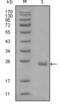 AXL Receptor Tyrosine Kinase antibody, abx011796, Abbexa, Enzyme Linked Immunosorbent Assay image 