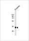 TST antibody, M00965-1, Boster Biological Technology, Western Blot image 