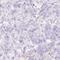 Amyloid P Component, Serum antibody, HPA053294, Atlas Antibodies, Immunohistochemistry frozen image 