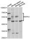 Receptor Interacting Serine/Threonine Kinase 3 antibody, STJ27384, St John