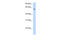 Solute Carrier Family 1 Member 4 antibody, ARP43827_P050, Aviva Systems Biology, Western Blot image 