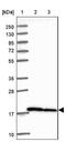 Ribosomal Protein S10 antibody, NBP2-47296, Novus Biologicals, Western Blot image 