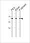 Proteasome Subunit Beta 2 antibody, PA5-35292, Invitrogen Antibodies, Western Blot image 