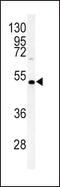 Diacylglycerol O-acyltransferase 2 antibody, PA5-26690, Invitrogen Antibodies, Western Blot image 