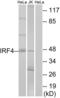 Interferon Regulatory Factor 4 antibody, abx013617, Abbexa, Western Blot image 