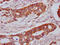 Lipoprotein Lipase antibody, LS-C680779, Lifespan Biosciences, Immunohistochemistry paraffin image 