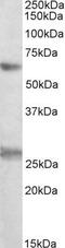 Eukaryotic Translation Initiation Factor 2B Subunit Delta antibody, PA5-19345, Invitrogen Antibodies, Western Blot image 