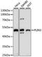 Perilipin 3 antibody, LS-C746771, Lifespan Biosciences, Western Blot image 