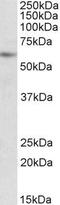 Protein Inhibitor Of Activated STAT 2 antibody, GTX88188, GeneTex, Western Blot image 