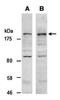 Lysine Demethylase 5C antibody, orb66994, Biorbyt, Western Blot image 