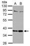 Selenoprotein P antibody, PA5-28281, Invitrogen Antibodies, Western Blot image 
