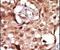 Receptor Interacting Serine/Threonine Kinase 2 antibody, PA5-14954, Invitrogen Antibodies, Immunohistochemistry paraffin image 