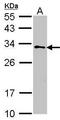 Glutathione S-Transferase Zeta 1 antibody, GTX106109, GeneTex, Western Blot image 